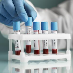 20. Conservación, transporte y remisión de muestras de laboratorio